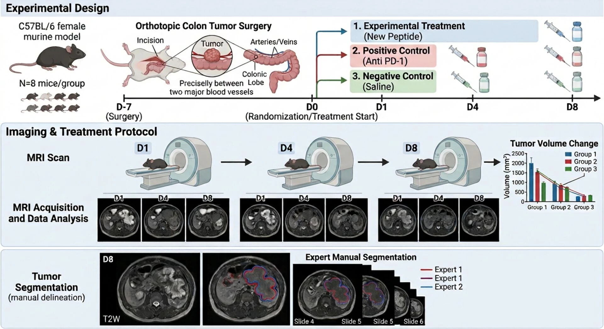 Antineo-colorectal cancer model-methods